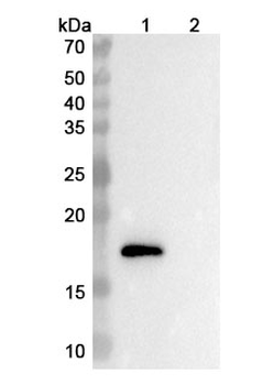 Ebrasodebart Human Monoclonal Antibody