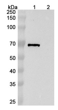 Ansipastobart Human Monoclonal Antibody