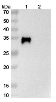 Verekitug Human Monoclonal Antibody
