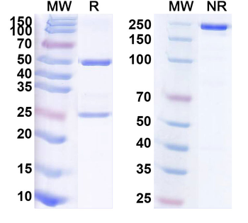ROR1 Human Monoclonal Antibody