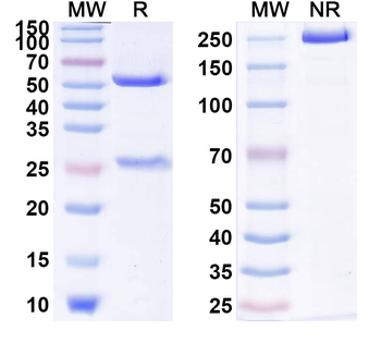 CD121a/IL1R1 Human Monoclonal Antibody