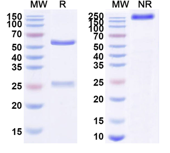 CD340/ERBB2/HER2/NEU Human Monoclonal Antibody
