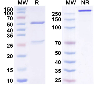 CD340/ERBB2/HER2/NEU Human Monoclonal Antibody