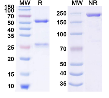 HIV-1 Glycoprotein 120/gp120 Human Monoclonal Antibody