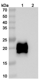 Volrustomig Human Monoclonal Antibody
