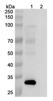 Fepixnebart Human Monoclonal Antibody