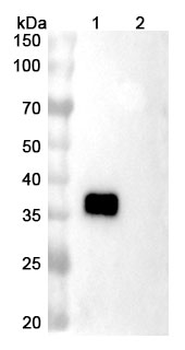 Danburstotug Human Monoclonal Antibody