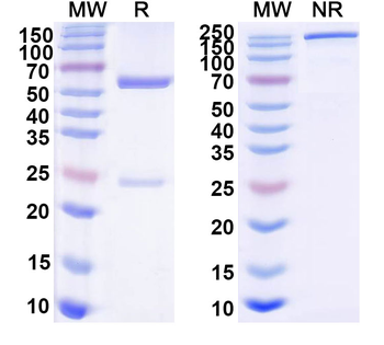 gp120SU Human Monoclonal Antibody