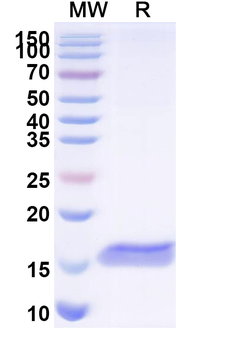 RSV F/Fusion glycoprotein F0 Monoclonal Antibody