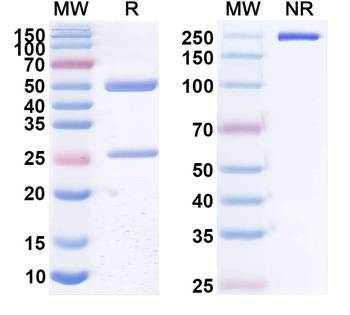CD20/MS4A1 Human Monoclonal Antibody