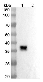 Lesabelimab Human Monoclonal Antibody