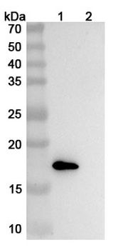 Xeligekimab Human Monoclonal Antibody