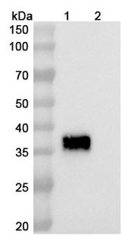 Tagitanlimab Human Monoclonal Antibody