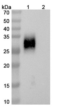 Zimbirelimab Human Monoclonal Antibody