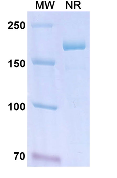 Human Kallikrein/KLKB1 Reference Antibody (Lanadelumab, RUO)