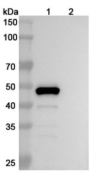 Belimumab Human Monoclonal Antibody