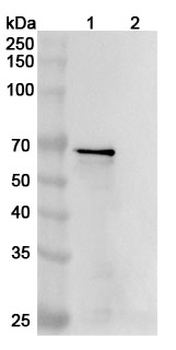MAPT/Tau/PHF-tau Human Monoclonal Antibody