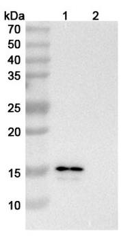 CM101 Human Monoclonal Antibody