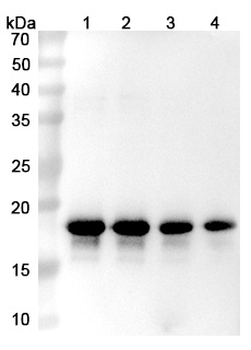 Prasinezumab Human Monoclonal Antibody