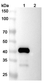 Lexatumumab Human Monoclonal Antibody
