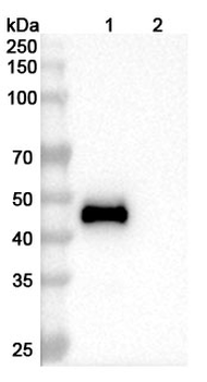 Mapatumumab Human Monoclonal Antibody