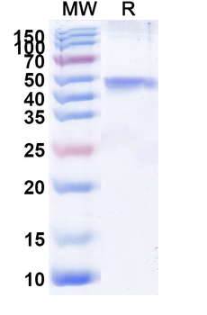 Recombinant CHIKV Spike glycoprotein E1 Protein, N-His