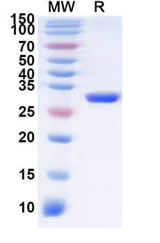 ASFV D117L Recombinant Protein (N-His-KSI)
