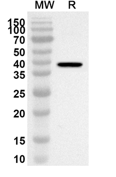 Avian HEV Capsid Polyclonal Antibody