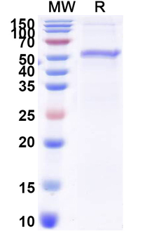 Recombinant Mouse SORT1 Protein, N-His