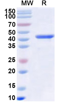 Human RNF126 Recombinant Protein (N-His)