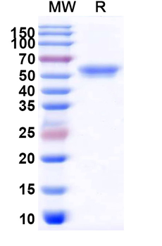 Recombinant Mouse CD292/BMPR1A Protein, C-Fc