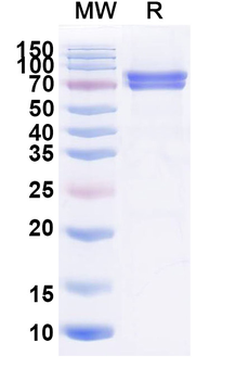 Mouse Carbonic Anhydrase IX/CA9 Recombinant Protein (C-Fc)