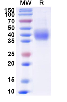 Recombinant Monkey CD38 Protein, C-His