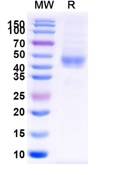 Recombinant Human CD84 Protein, C-His