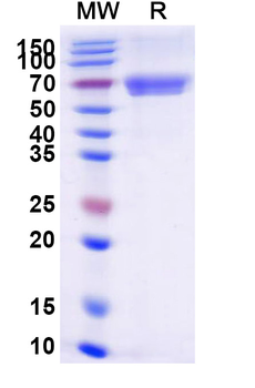 Recombinant Human CD84 Protein, C-Fc
