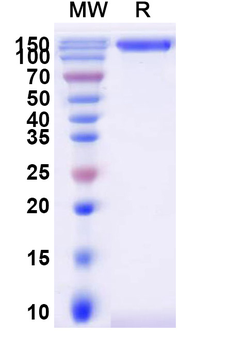 Recombinant Human CD66e/CEACAM5 Protein, C-Fc