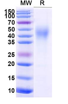 Recombinant Mouse CD332/FGFR2 Protein, C-His