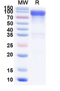 Recombinant Mouse CD333/FGFR3 Protein, C-Fc