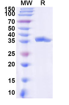 Recombinant Human SLC6A9 Protein, N-GST & C-His