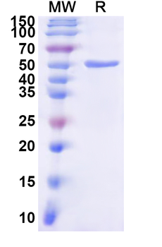 Recombinant Human UGT1A6 Protein, N-His