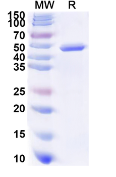 Recombinant Human UGT1A1 Protein, N-His