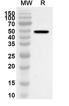 Human UGT1A1 Polyclonal Antibody