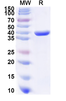 Human BCKDHB Recombinant Protein (N-His)