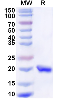 Recombinant Human LMO2 Protein, N-His