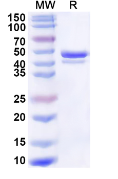 Human DDX6 Recombinant Protein (N-His)