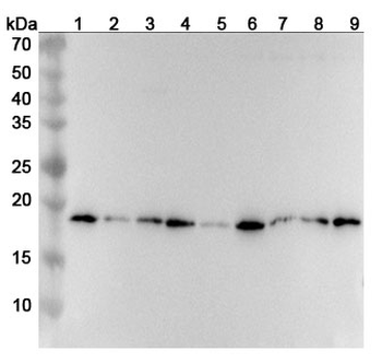 RPL12 Polyclonal Antibody