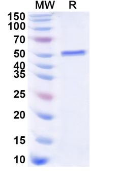 Recombinant Human HOXC9 Protein, N-His-KSI