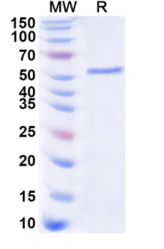 Recombinant Human HOXC13 Protein, N-His-KSI