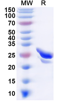 Recombinant Human GTF2F1 Protein, N-His