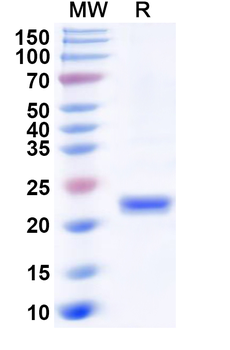 Recombinant Human PSMB10 Protein, N-His